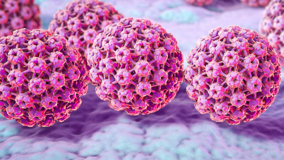 Tot ce trebuie sa stii despre HPV: Simptome & Tratament Virusul papiloma cu risc oncogen ridicat
